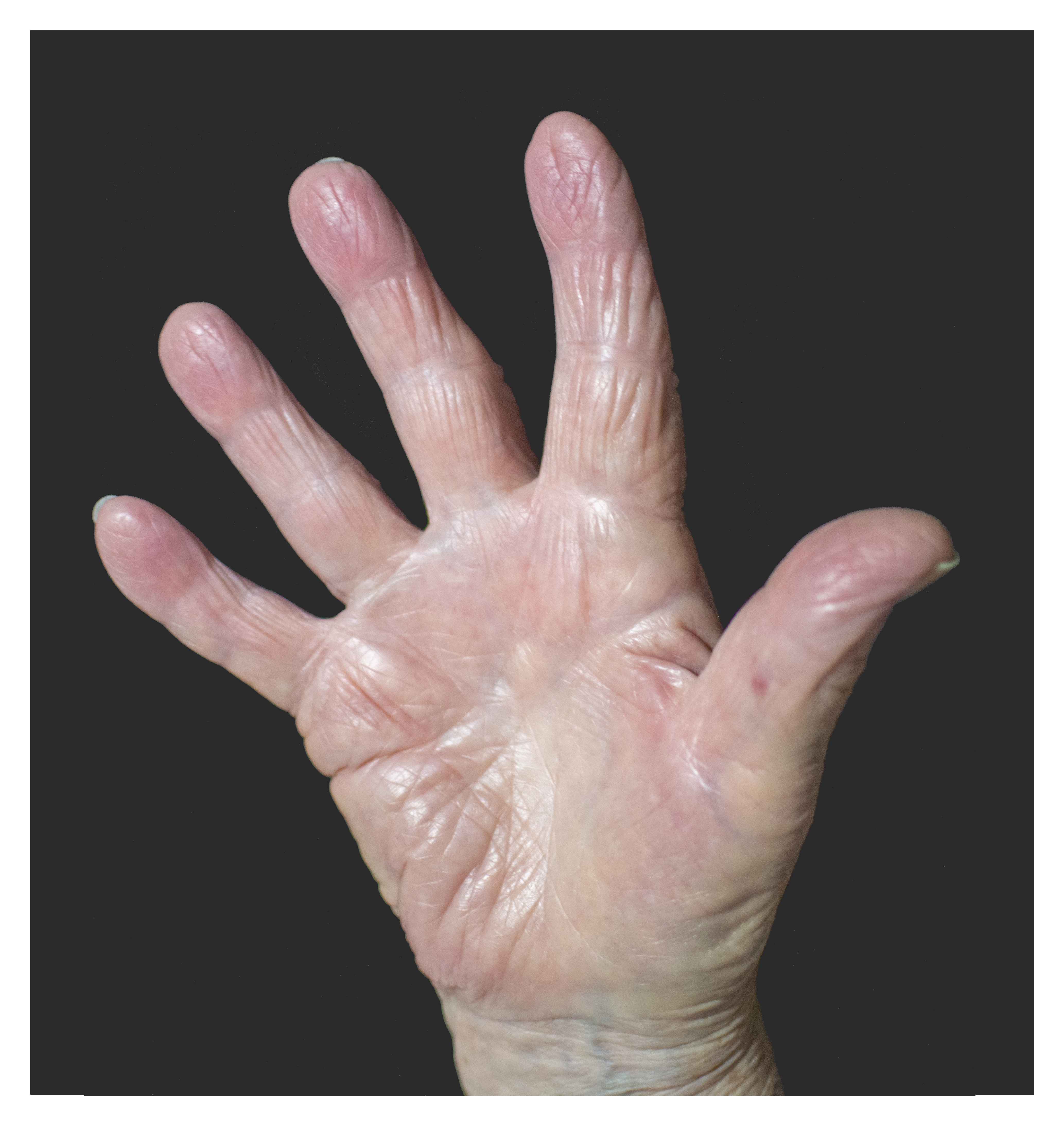 Female palm