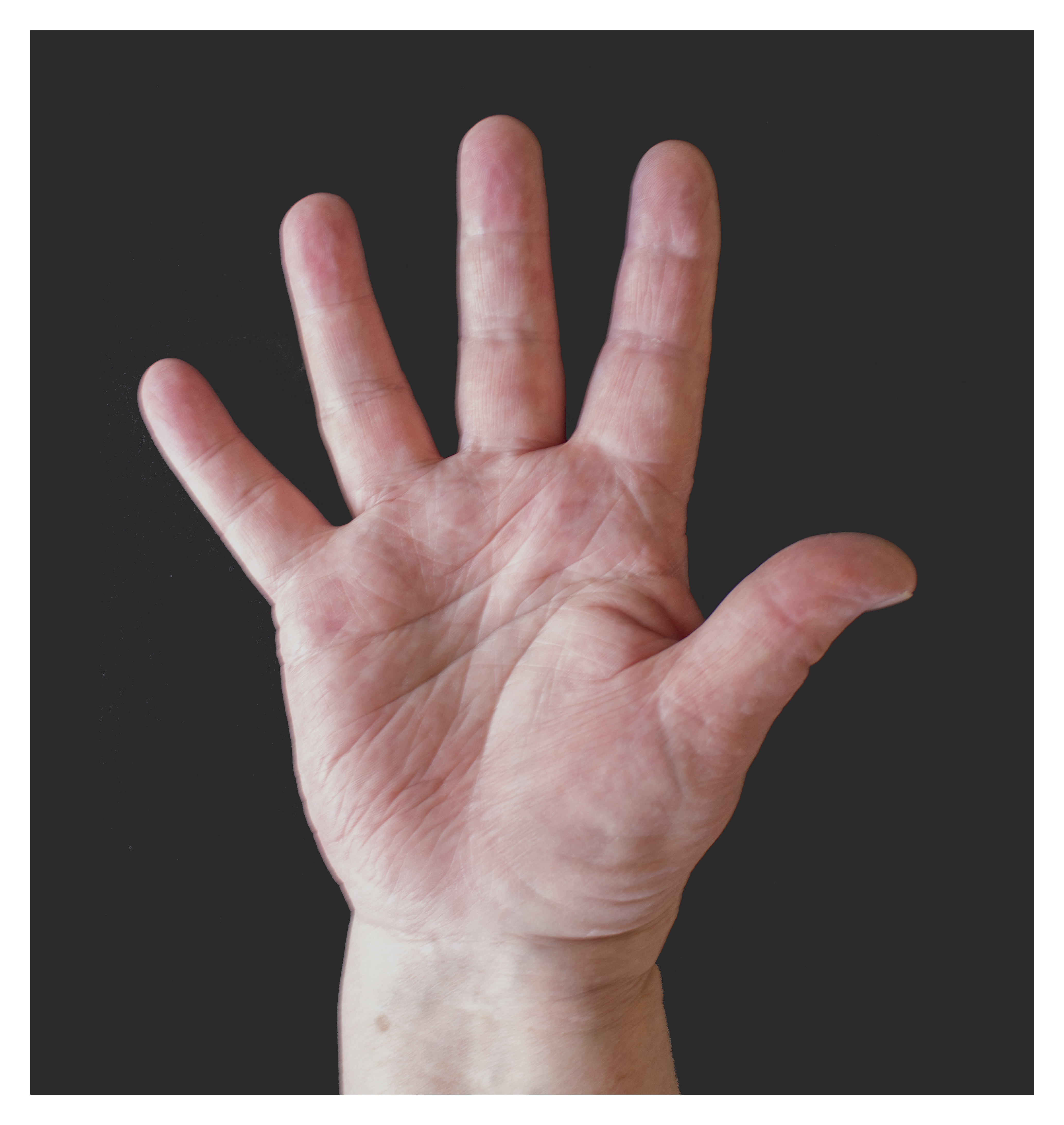 Female palm